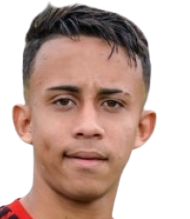 Gonzalves